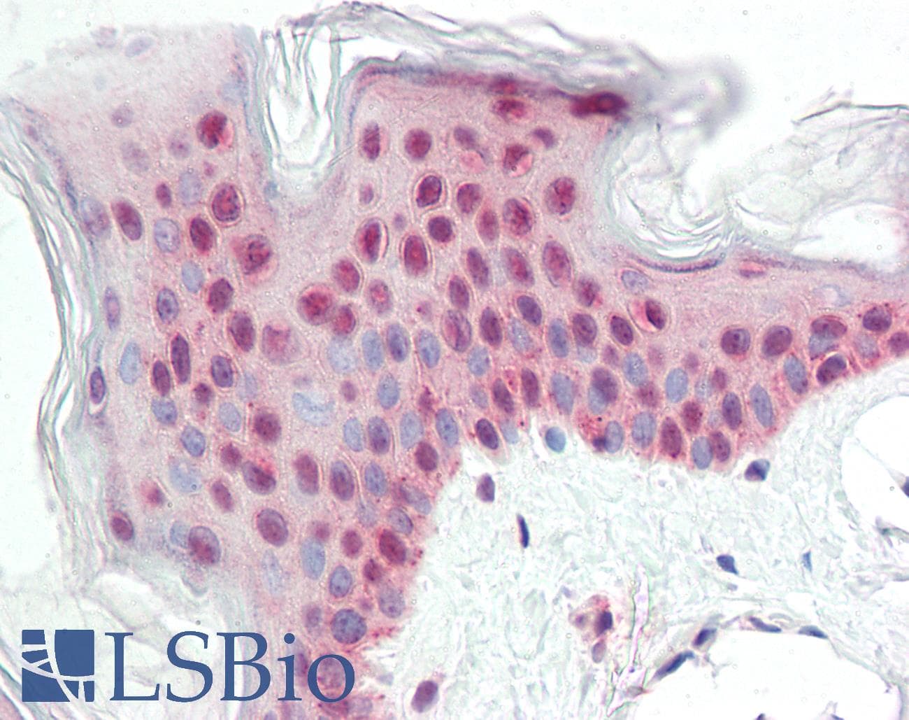 IHC-plus™ Polyclonal Rabbit anti-Human ATG14 Antibody (IHC, IF, WB)