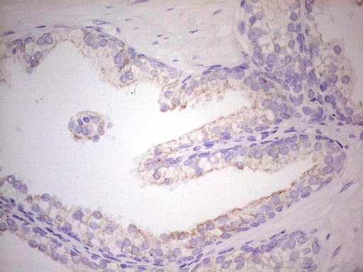 ABCB1 / MDR1 / P Glycoprotein Antibody (aa995-1280, clone OTI10H3)