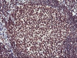 FMR1 / FMRP Antibody (clone OTI1C6)