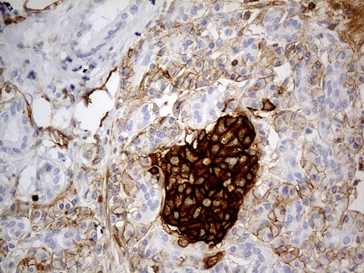 CD99 Antibody (clone OTI1A1, Carrier-free)