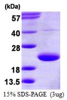 Human TRAPPC3 Protein (Recombinant His)