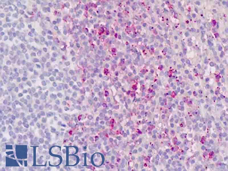 PathPlus™ Polyclonal Rabbit anti-Human RORC / ROR Gamma Antibody (Ligand-binding Domain, IHC)