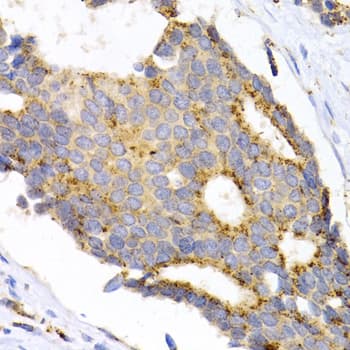 MMP11 Antibody