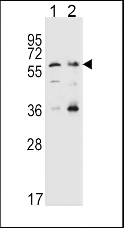 IHC-plus™ Polyclonal Rabbit anti-Human SLC22A4 / OCTN1 Antibody (aa514-542, IHC, WB)