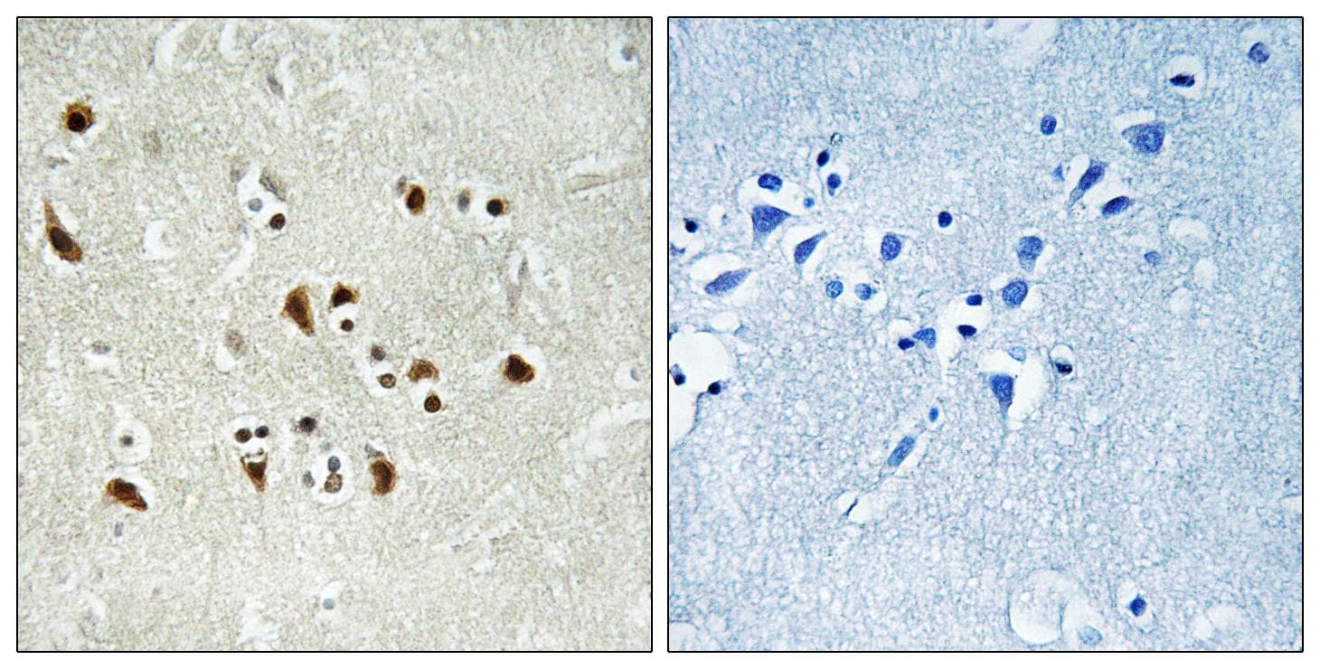TUBGCP6 / GCP6 Antibody