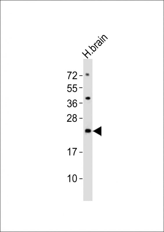 Polyclonal Rabbit anti-Human FAM168B Antibody (aa105-139, WB)