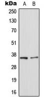LGALS8 / Galectin 8 Antibody (Internal)