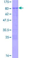 Human PLAGL2 Protein (Recombinant GST)