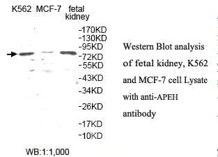 Polyclonal Rabbit anti-Human APH / APEH Antibody (aa2-197, IHC, WB)