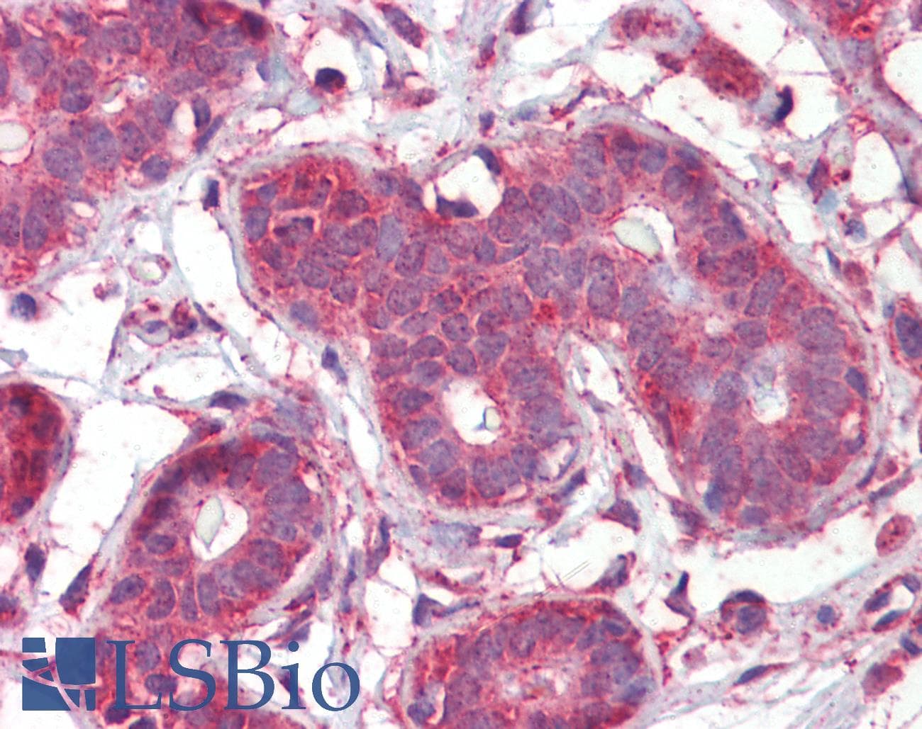 IHC-plus™ Polyclonal Goat anti-Human SEPT2 / Septin 2 Antibody (aa37-49, IHC, WB)