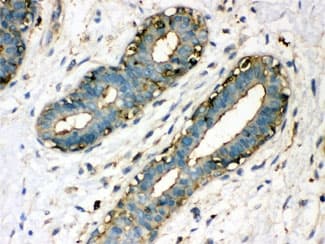TGM2 / Transglutaminase 2 Antibody