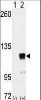 IHC-plus™ PUM2 Antibody (Ser182)