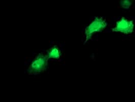 RBP1 / CRBP Antibody (clone 2.00E+01, Carrier-free)