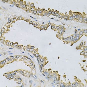 Polyclonal Rabbit anti-Human APRT Antibody (aa1-180, IHC, WB)