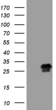 CTLA4 / CD152 Antibody (clone OTI1E2)