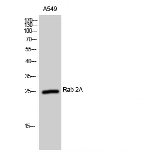 RAB2A / RAB2 Antibody (60-140 aa, Internal)
