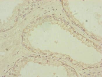 Polyclonal Rabbit anti-Human PDHA2 / PDH E1 Beta Antibody (IHC, WB)