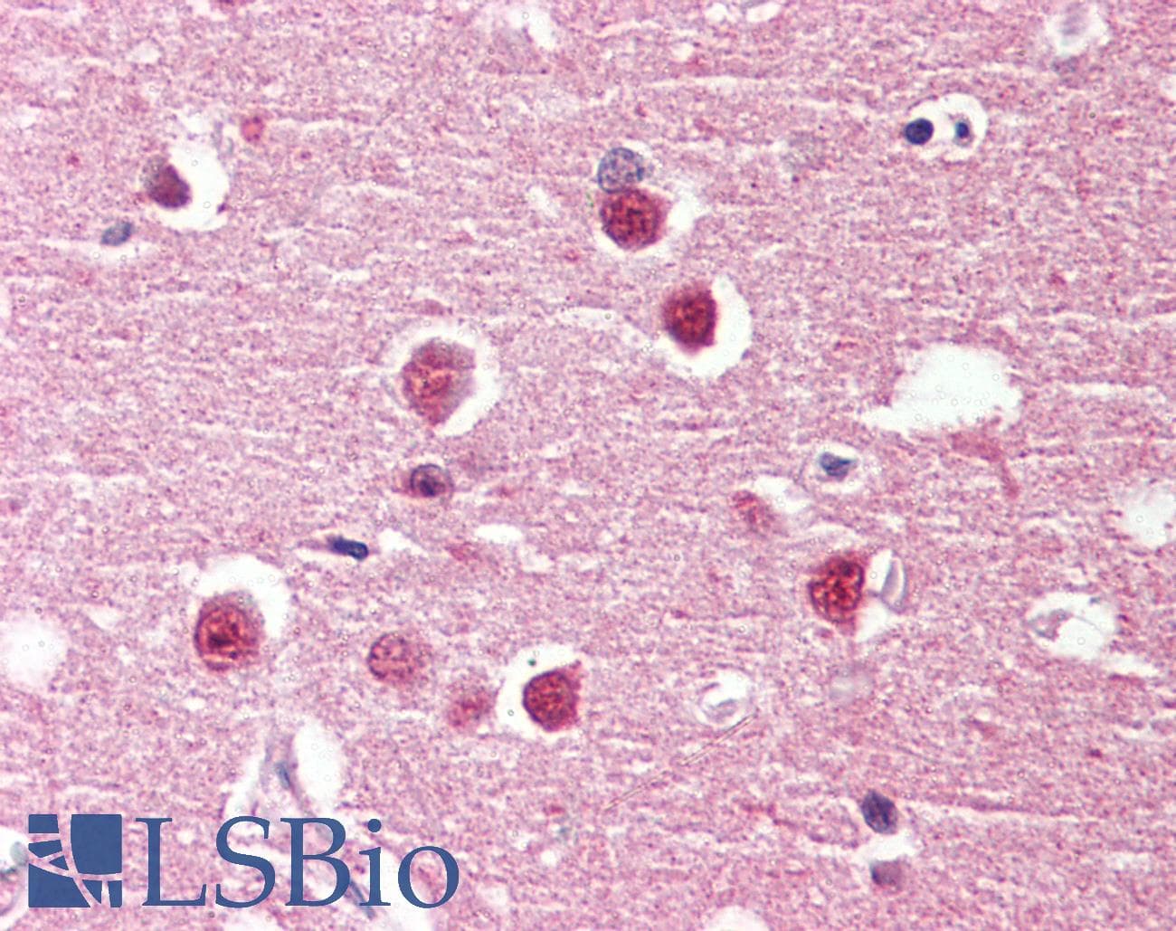 IHC-plus™ ADGRV1 / GPR98 Antibody (Internal)