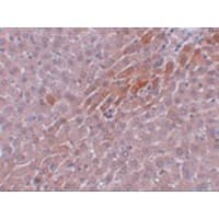 Polyclonal Rabbit anti-Human TBKBP1 Antibody (IHC, IF, WB)