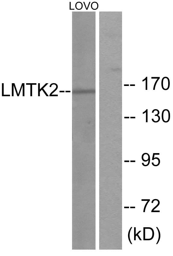 IHC-plus™ KPI-2 / LMTK2 Antibody (aa651-700)