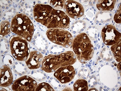 PTPN22 / PEP Antibody (aa359-449, clone OTI6B1)