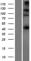 CEP44 / KIAA1712 Protein (Over-Expression Lysate Myc-DDK (Flag))