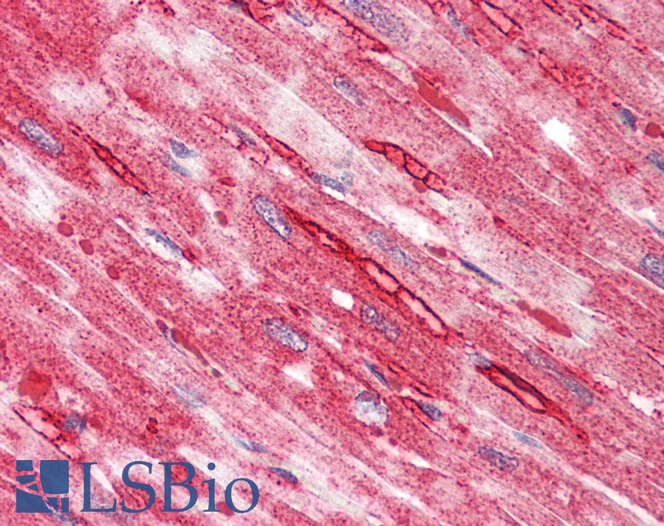 IHC-plus™ Polyclonal Rabbit anti-Human TTYH2 Antibody (IHC, IF, WB)
