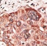 Recoverin Antibody (aa169-200)