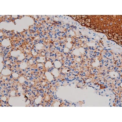 AKT1 Antibody (phospho-Ser124)