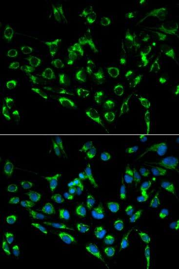 CDKN3 / KAP Antibody