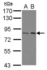 BRAT1 / BAAT1 Antibody (N-Terminus)