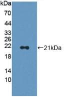 CAP2 Antibody (aa317-455, APC)