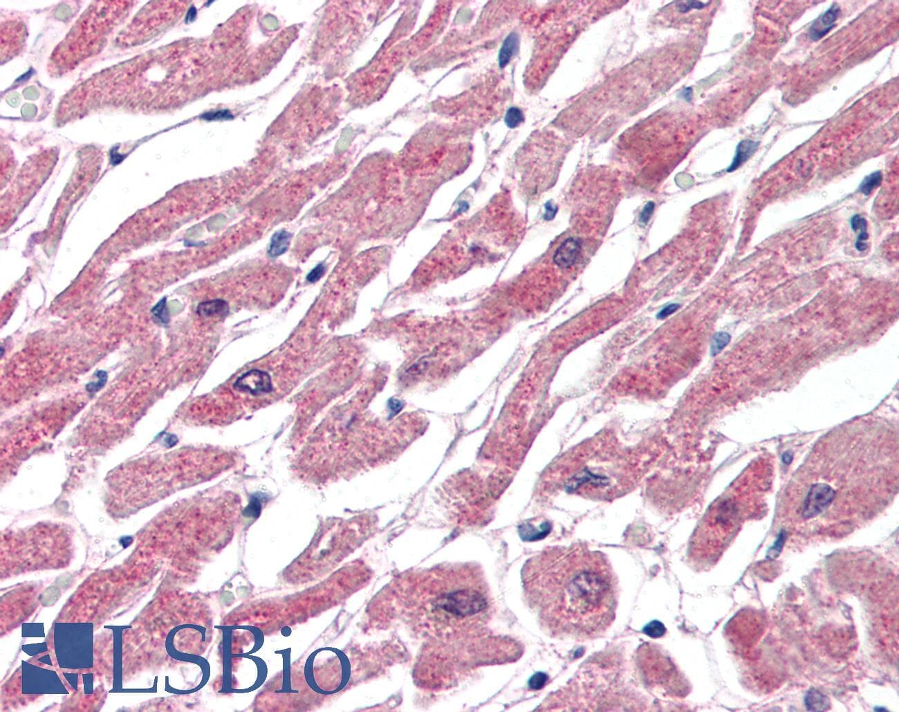 IHC-plus™ CPT1B Antibody (aa760-772)