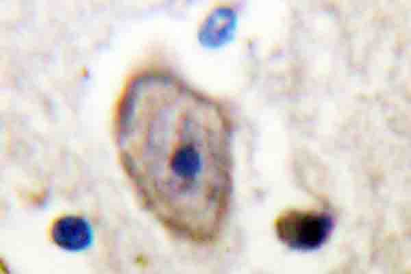 KCNC4 / Kv3.4 Antibody (Arg11)