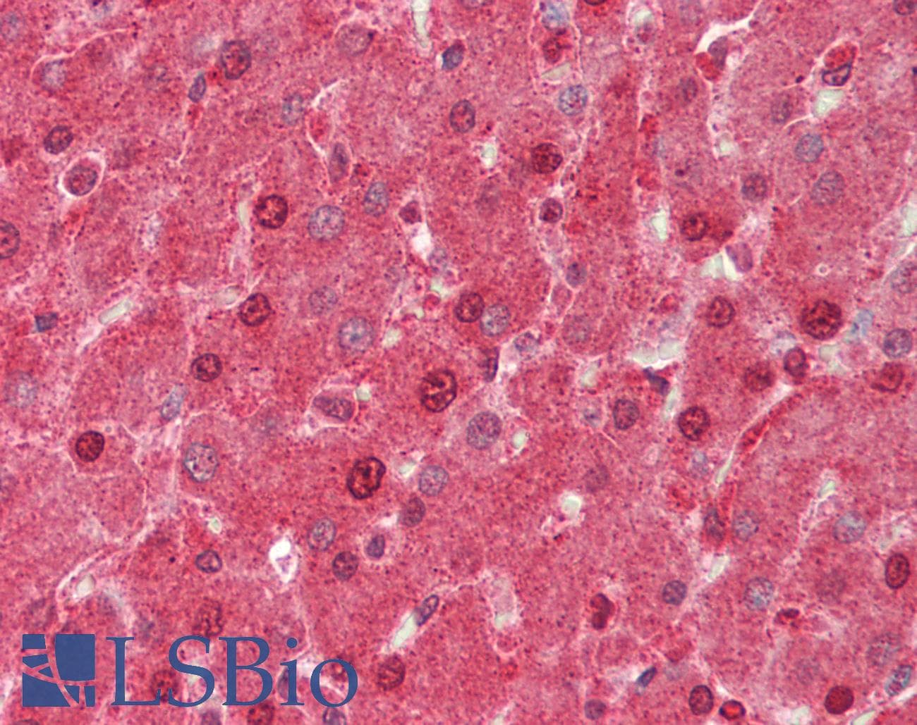 Polyclonal Rabbit anti-Human AIRE Antibody (N-Terminus, IHC, WB)