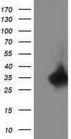 RTFDC1 Antibody (clone OTI1E8)