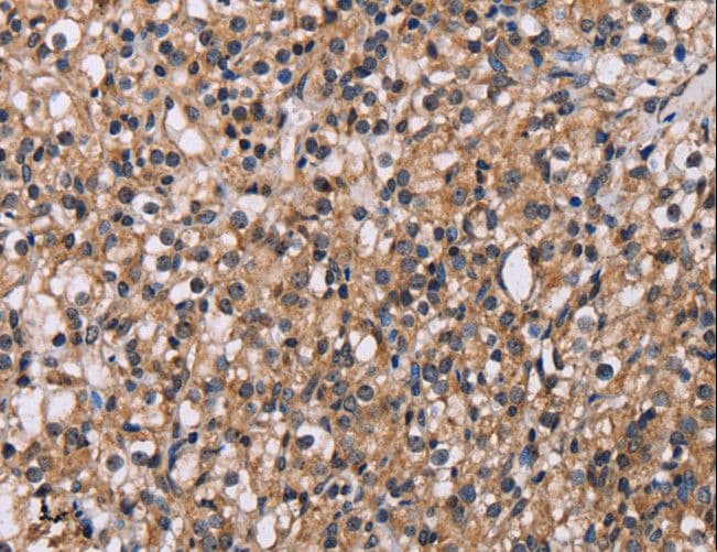 GNL3 / NS / Nucleostemin Antibody