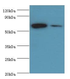 Polyclonal Rabbit anti-Human CARD9 Antibody (aa237-536, IHC, WB)