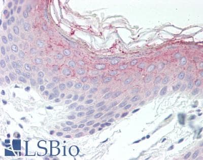 IHC-plus™ Polyclonal Rabbit anti-Human DSC1 / Desmocollin 1 Antibody (IHC, WB)