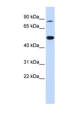 TRMT1 Antibody (aa36-85)