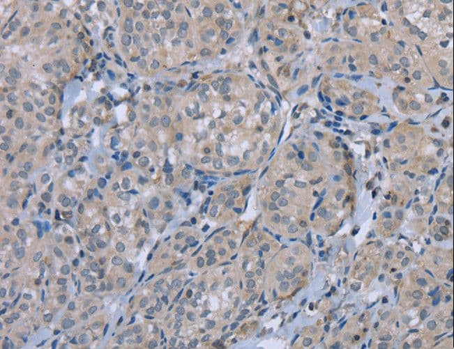 FAP Alpha Antibody