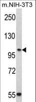 IHC-plus™ Polyclonal Rabbit anti-Human CDH3 / P-Cadherin Antibody (aa114-142, IHC, WB)