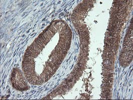 PROSC Antibody (clone OTI1G2)