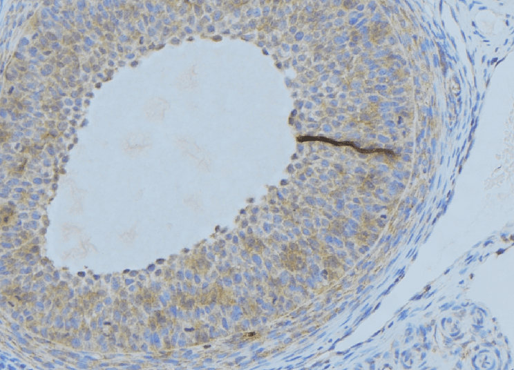 IGF1 Antibody