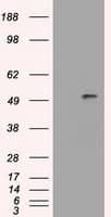 IHC-plus™ SERPINA1 / Alpha 1 Antitrypsin Antibody (clone 5B12)