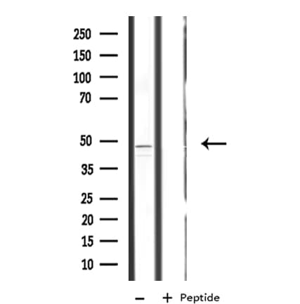 Polyclonal Rabbit anti-Human RAD23A / HHR23A Antibody (WB)