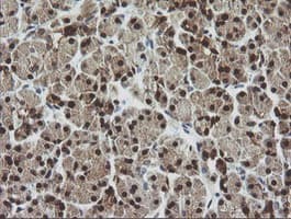 CMPK / CMPK1 Antibody (clone OTI2F5, Carrier-free)