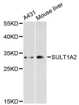 Polyclonal Rabbit anti-Human SULT1A2 / Sulfotransferase 1A2 Antibody (WB)