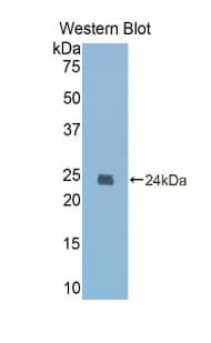 CASP1 / Caspase 1 Antibody (aa119-296, APC)