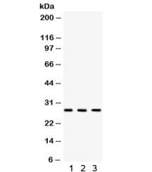 Polyclonal Rabbit anti-Human DKK2 Antibody (WB)